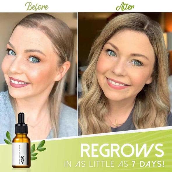 Gro+ matu aktivizējošs serums - Image 3