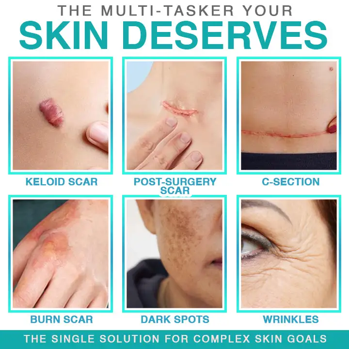 𝗖𝗮𝗿𝗲𝗕𝗿𝗲𝗲𝘇𝗲® 3-in-1 mikroadatas kopšanas plāksteris - Image 2