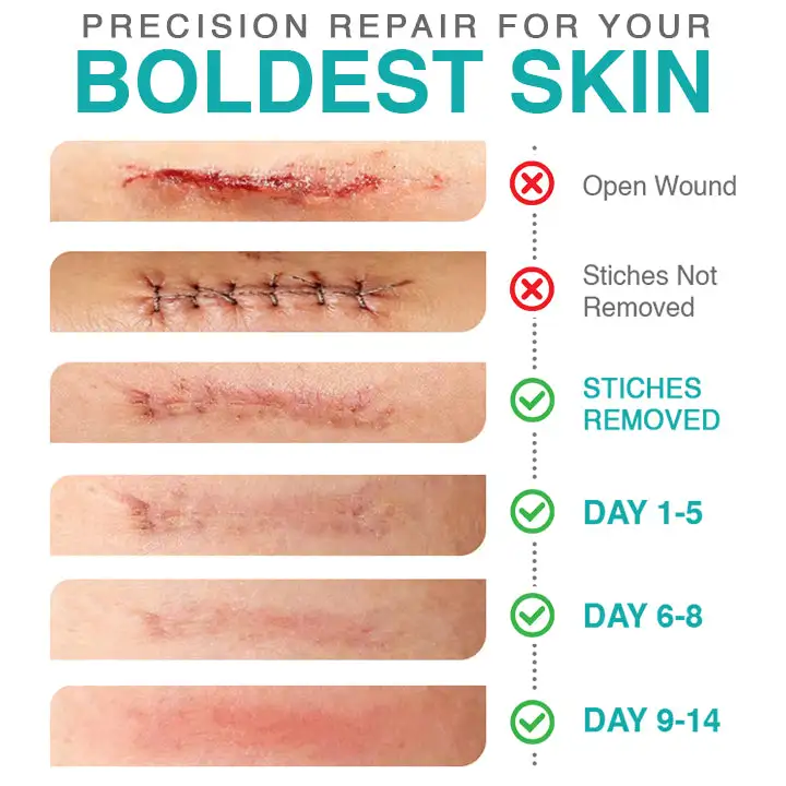 𝗖𝗮𝗿𝗲𝗕𝗿𝗲𝗲𝘇𝗲® 3-in-1 mikroadatas kopšanas plāksteris - Image 4