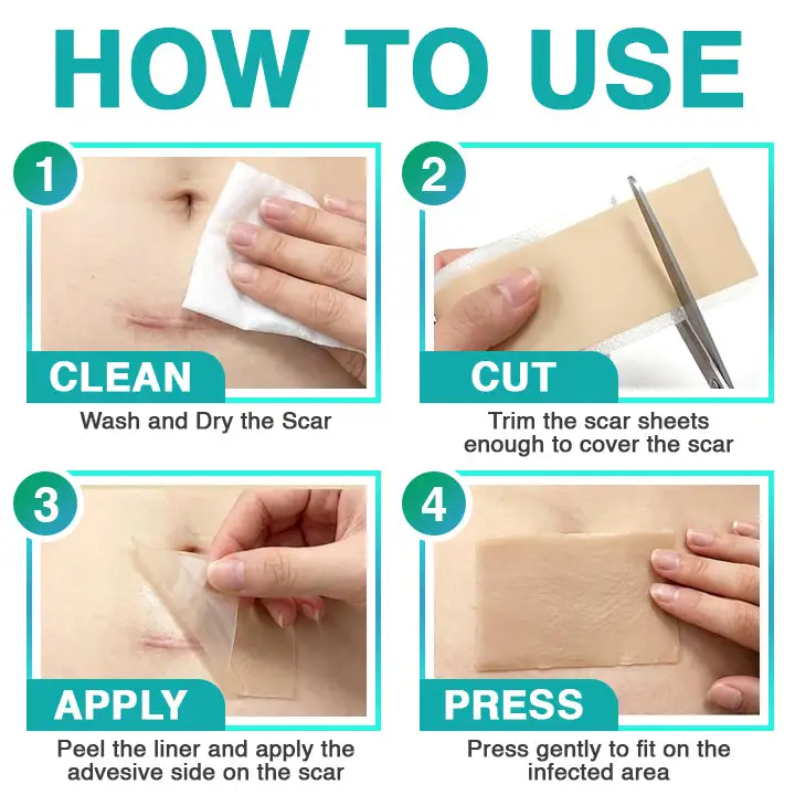 𝗖𝗮𝗿𝗲𝗕𝗿𝗲𝗲𝘇𝗲® 3-in-1 mikroadatas kopšanas plāksteris - Image 7