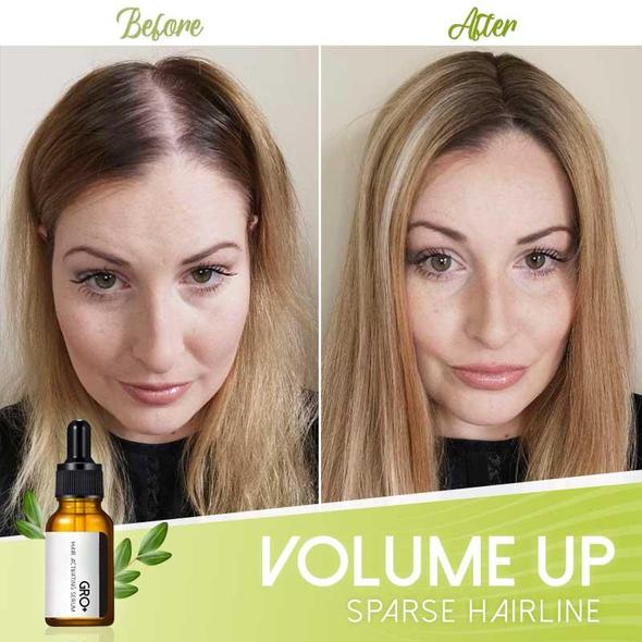 Gro+ matu aktivizējošs serums - Image 4