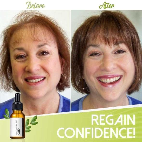 Gro+ matu aktivizējošs serums - Image 6