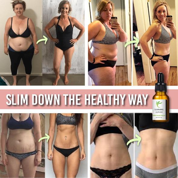 Vēdera josta ar tauku sadedzināšanas serumu - Image 6