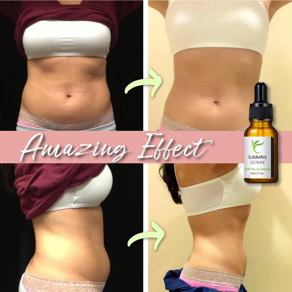 Vēdera josta ar tauku sadedzināšanas serumu - Image 7