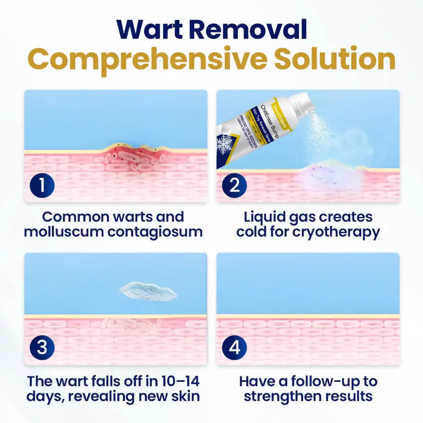 DermChiller® ChillErase izsitumu un ādas marķējuma atjaunošanas aerosols - Image 4