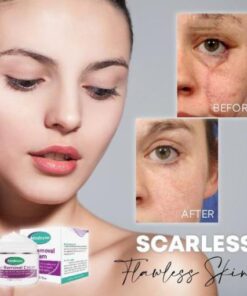 Medease Skin Rebound krēms