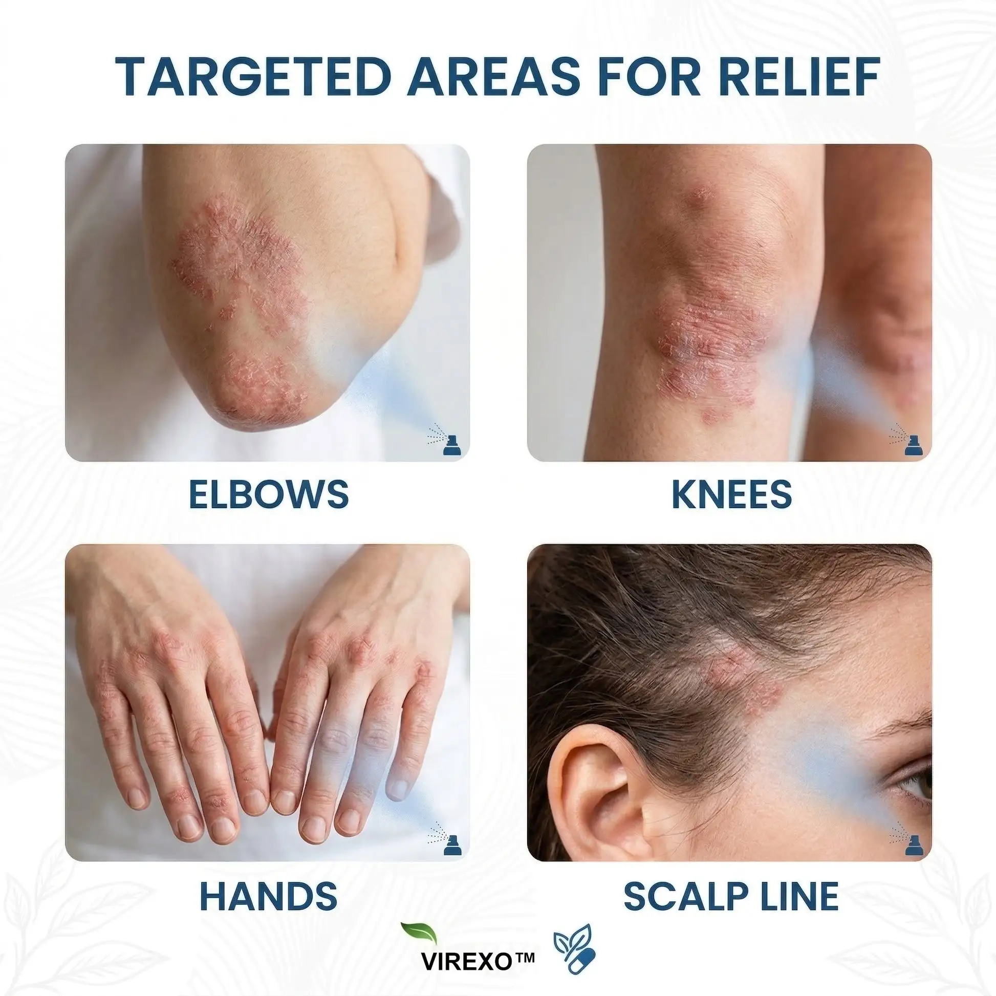 Virexo™ magnija botāniskais aerosols - Image 2