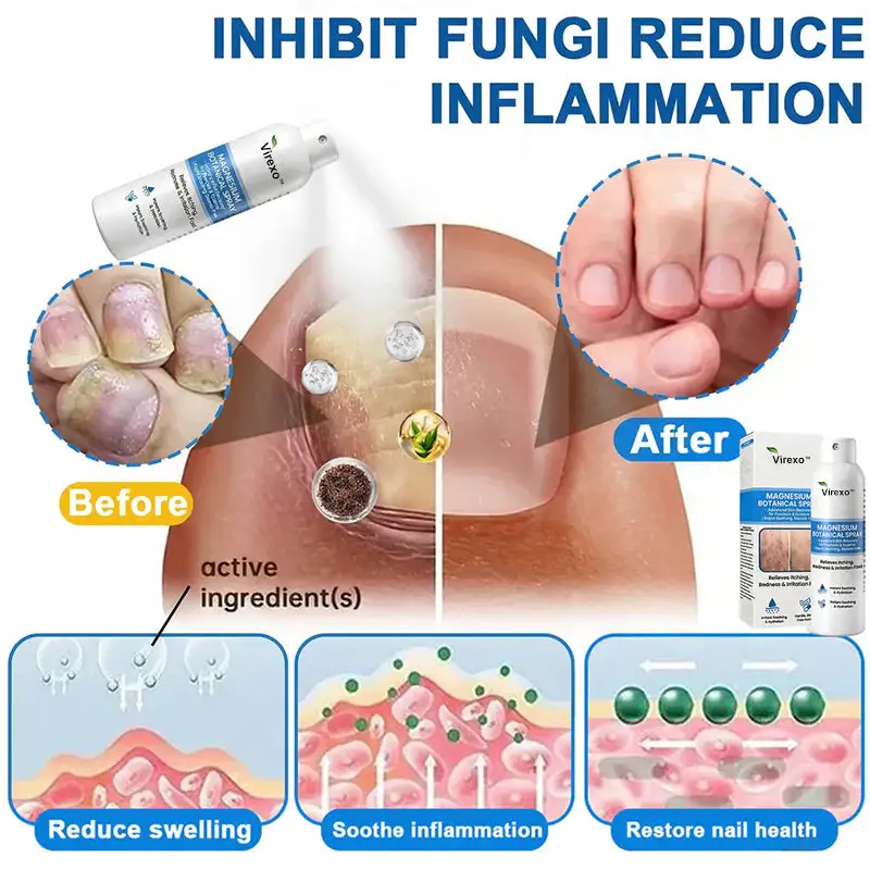 Virexo™ magnija botāniskais aerosols - Image 4