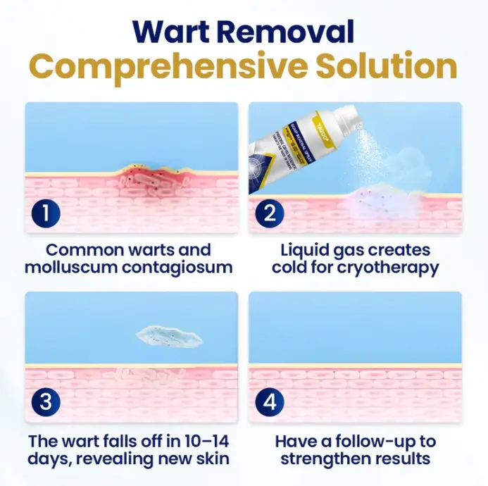 Yagoo® Chillique izciļņu atjaunojošs aerosols - Image 3