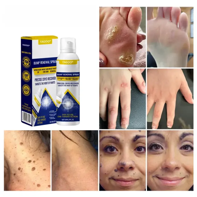 Yagoo® Chillique izciļņu atjaunojošs aerosols - Image 5